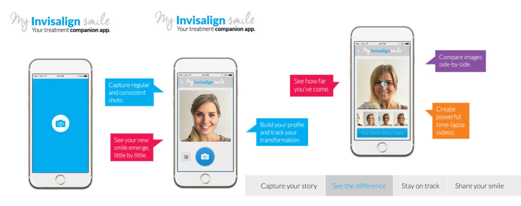 My invisalign smile: la app para pacientes de ortodoncia invisible ...